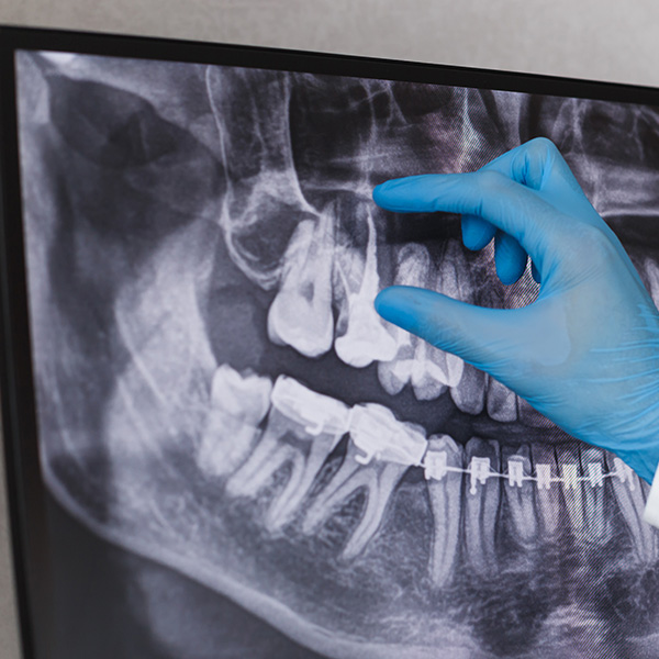 Brittney K. Craig, DMD | Porcelain Veneers, Bonding and Preventative Program