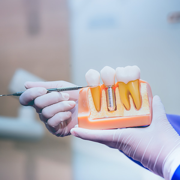 Brittney K. Craig, DMD | TMJ Disorders, Crowns and Bridgework and Fluoride Treatment