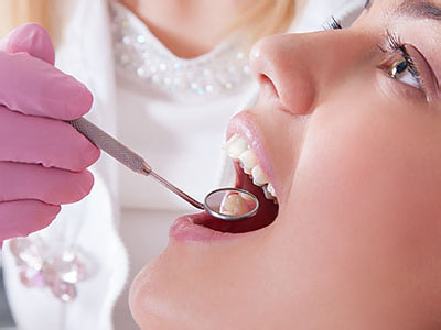 Brittney K. Craig, DMD | Dental Fillings, Bonding and Dental Sealants